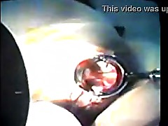 Zhangjiajing(nurses)0017((Myfuckedhavingsesvideo)