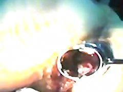 Zhangjiajing Nurses Taiwanese Taiwan Nurses(45